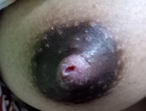 NIPPLE .