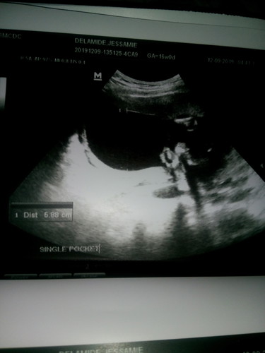 FIVE MONTHS?