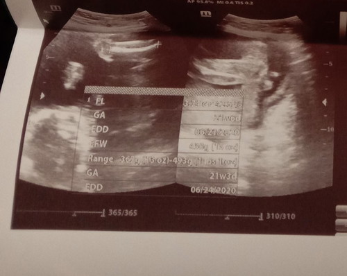 it's a baby girl ?