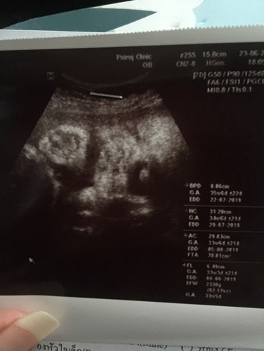 นับถอยหลังแล้วนะคะลูก