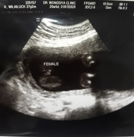 ขอความคิดเห็นหน่อยค่ะ