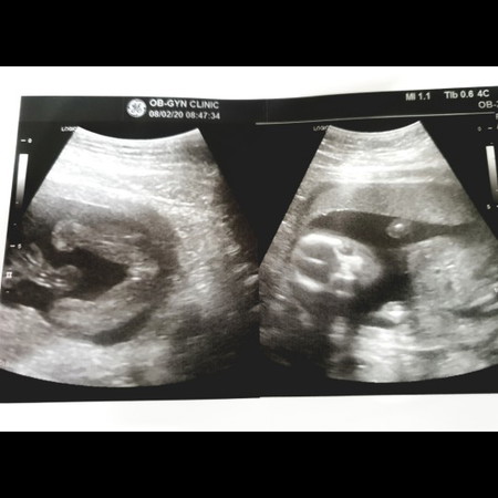 อยากทราบว่าน้องเพศไหนค่ะ ?