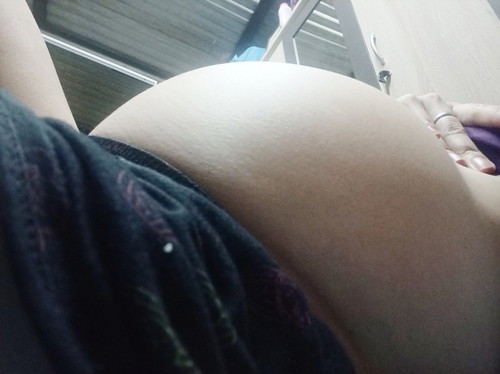 31w ??ปวดหลังมาก