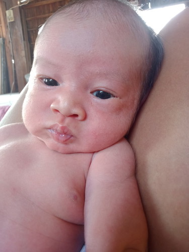 ใครมีลูกดูดนมแรงบ้างค่ะ ดูดจนหัวนมแตกเลย