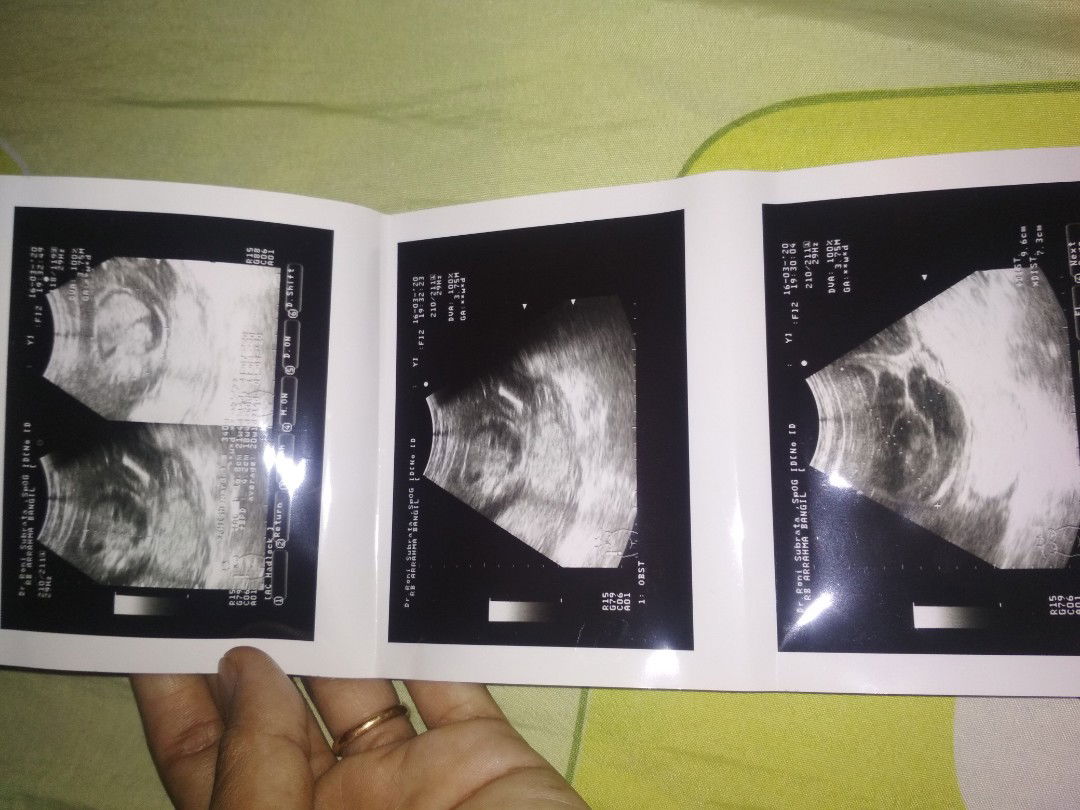 bun mohon jawabannya bagi yang tau..