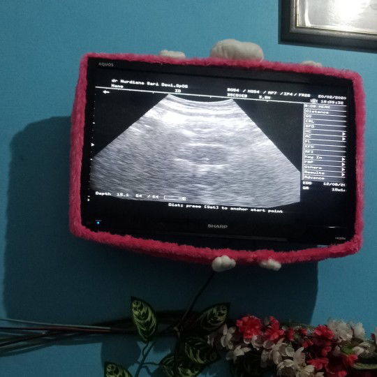 apa saja yg d hindari trismester pertama?