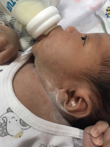 บ้านไหนเป็นบ้างค่ะ⁉️