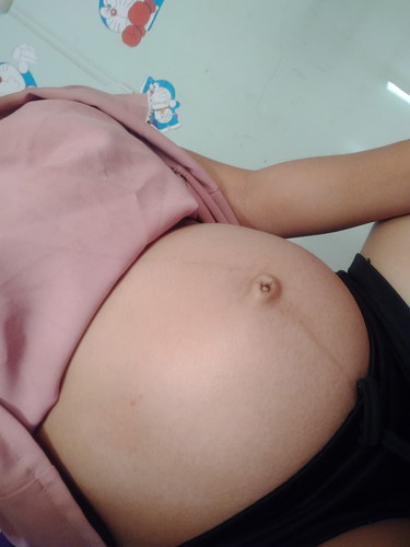ท้อง 26w 3d