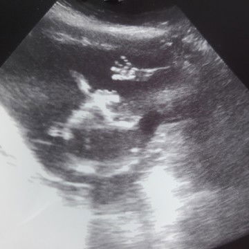 มาดูน้องกันหน่อยคะ