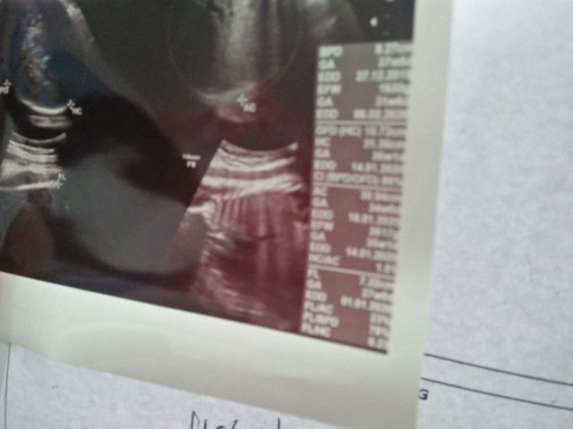 Pendapat yang pengalamannya sama