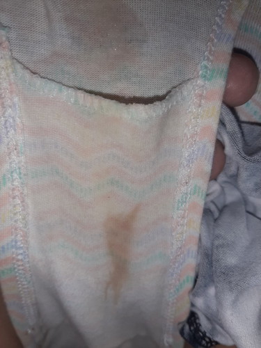 pag ganito po ba discharge manganganak na?38 weeks 6days