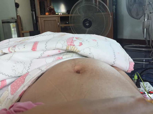 โกงตัวหรือมดลูกลอย