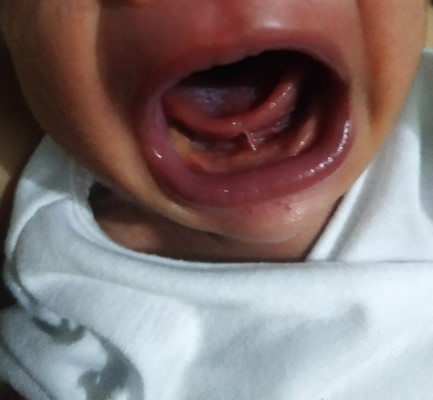 tounge tied?