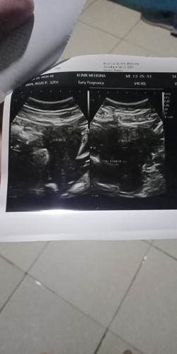 12w di usg tak nampak janin