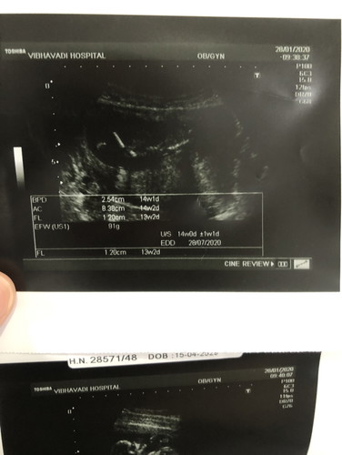 13 wk 5 วัน น้ำหนักลูกประมานเท่าไหร่กันเเล้วค่ะ