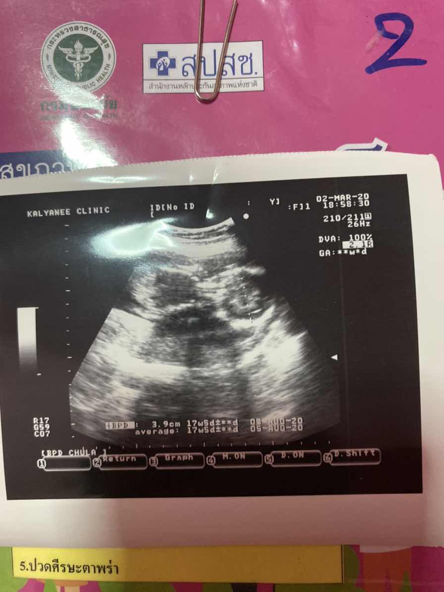 ใครเคยซาวแบบนี้แล้วผิดพลาดเป็นอีกเพศไหมค่ะ