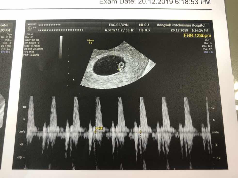 แข็งแรงๆนะลูก