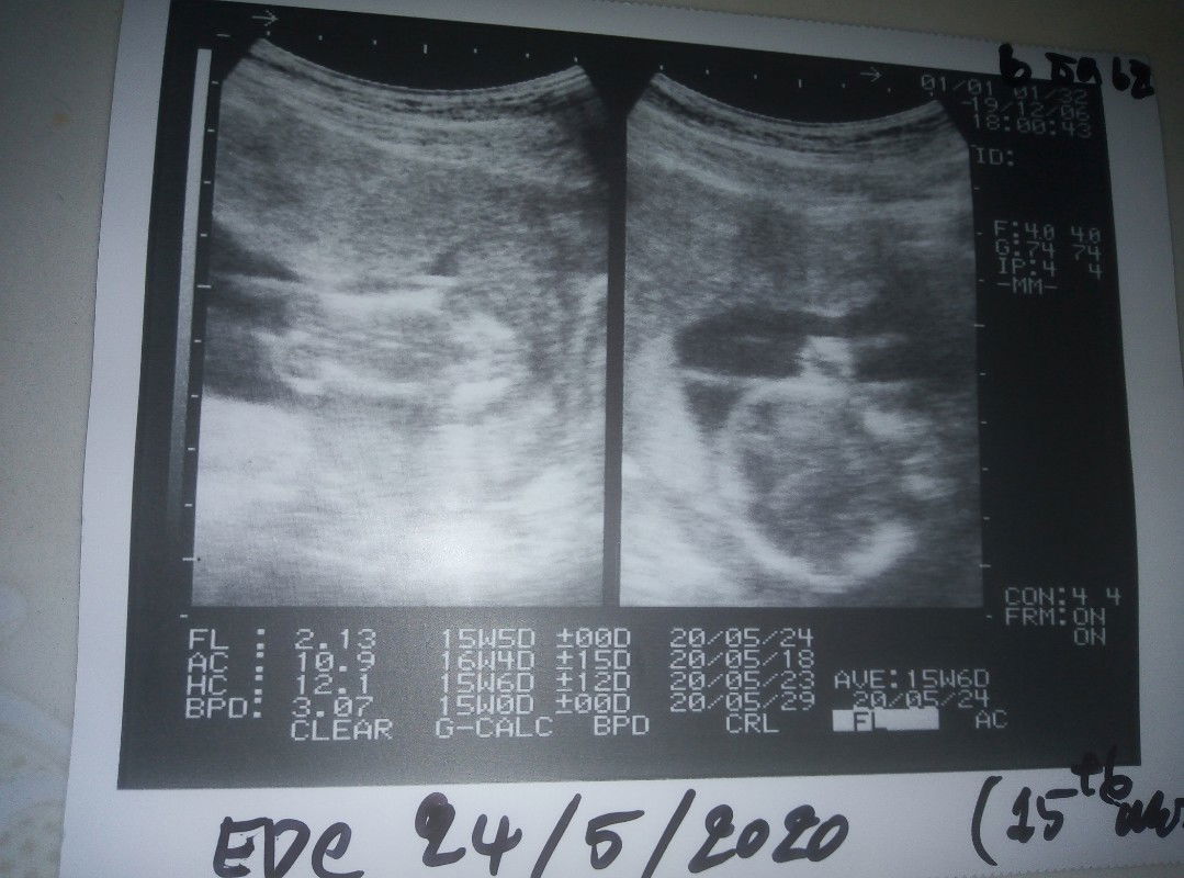 ไม่รู้ว่าตัวเองตั้งครรภ์