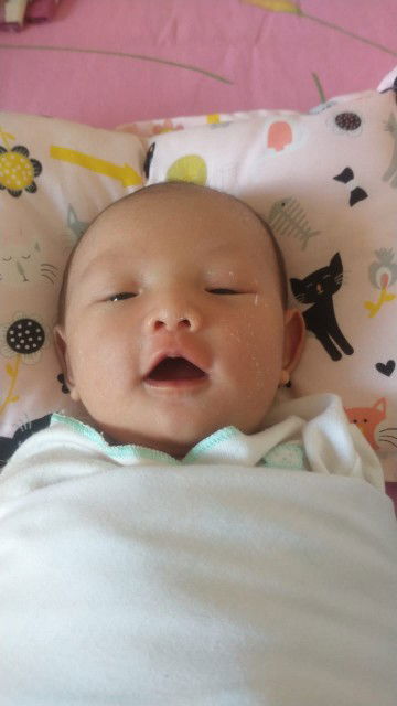 luka ceasar kluar nanah dan memberi asi