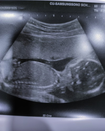 18 w 2 d ❤️?