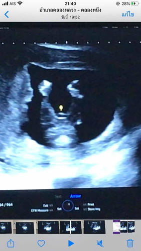 สอบถามแม่ๆ