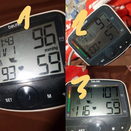 ความดันต่ำ