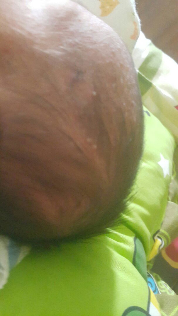 apakah ini alergi ya bund?