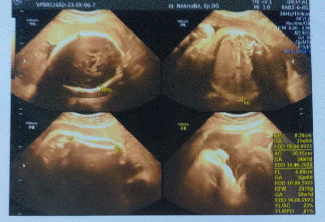 gita putri ramadhanti profile icon