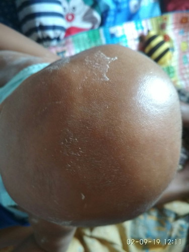 Kepala Peyang..