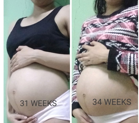 CURRENTLY 34 WEEKS