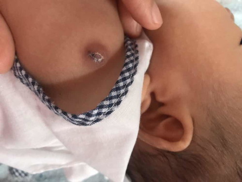 ปลูกฝี