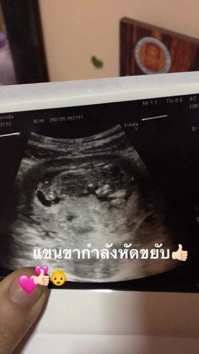 ตั้งครรภ์