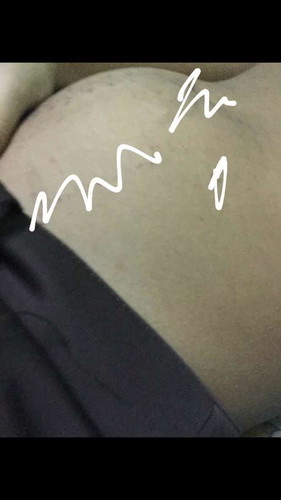 16w+4