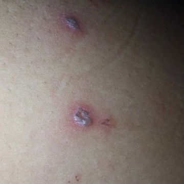 kena tomcat bukan yaa???