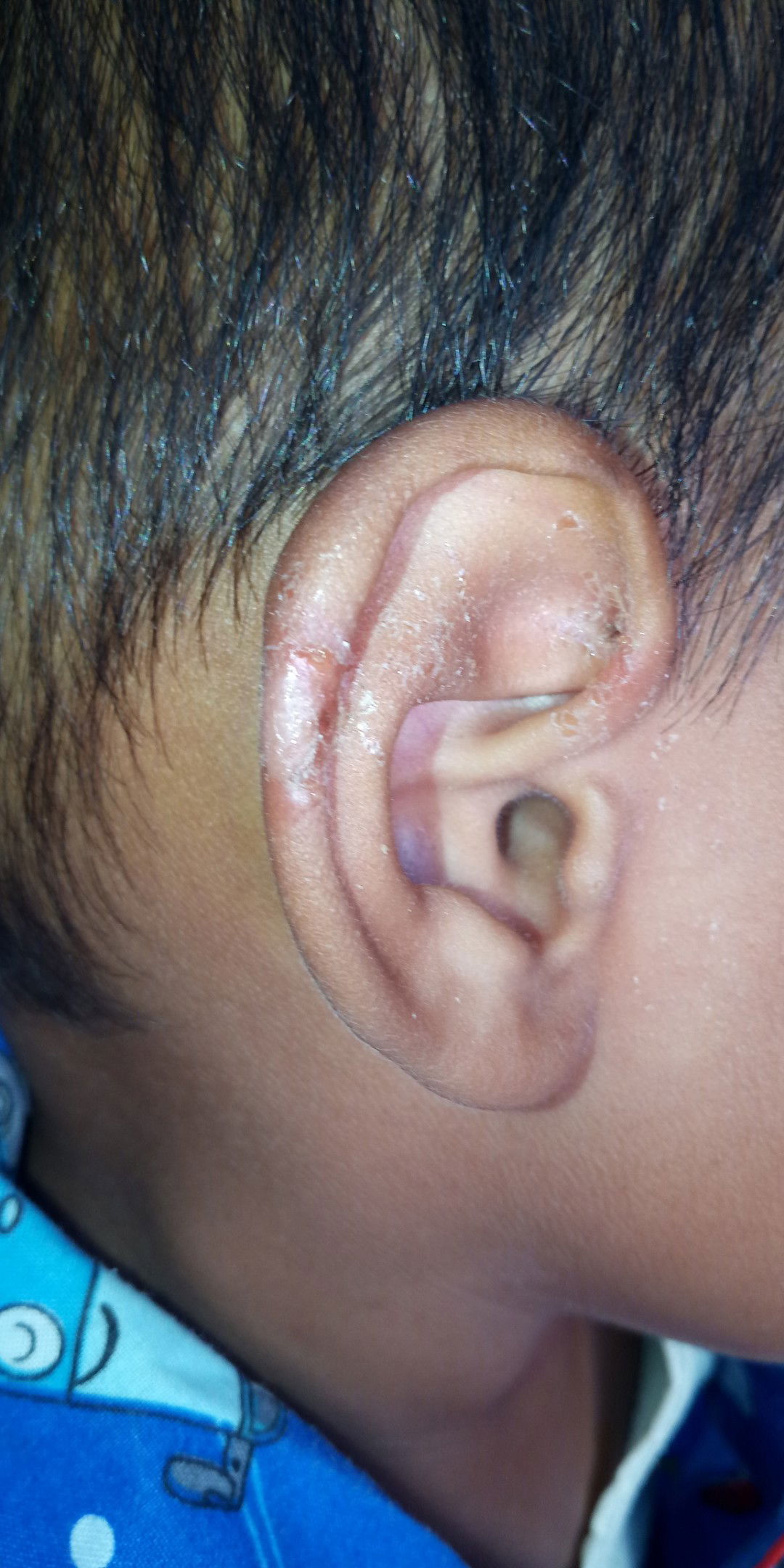 luka.. jangan dibuka kalo jijik