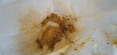 น้องได้15วัน