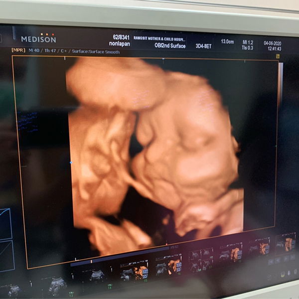 Mind Nonlapan profile icon