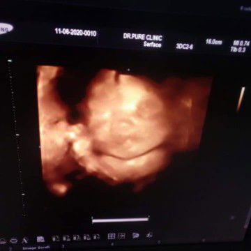 ทีมกันยาครับ❤️❤️