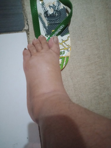 manas is it normal?