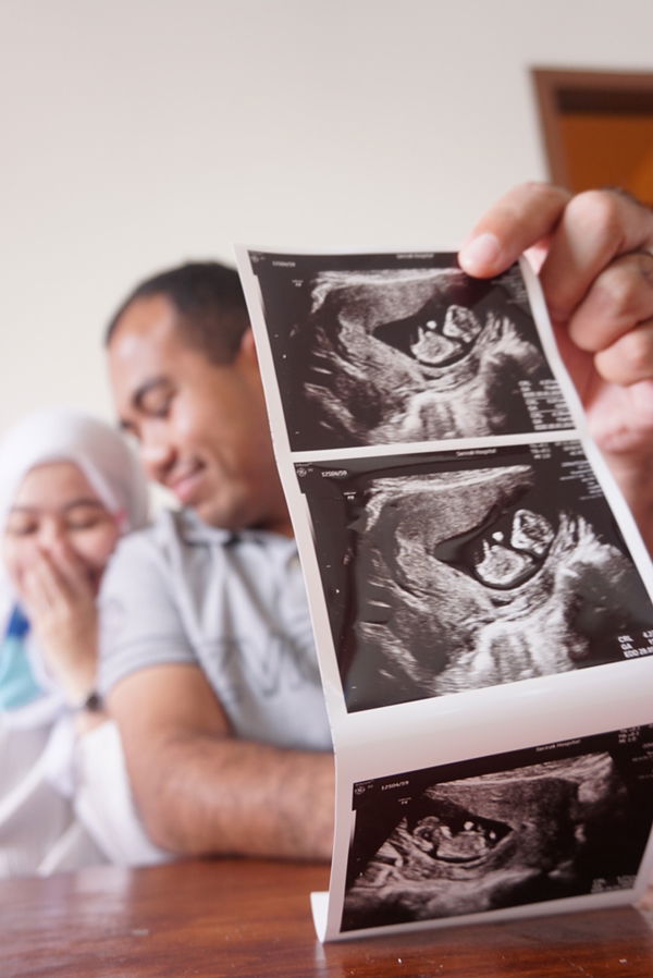 Chan Chao profile icon