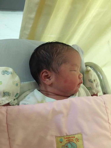 สวัสดีค่ะ น้องจูนมารายงานตัวกับประสบการณ์ผ่าคลอดบล็อกหลัง