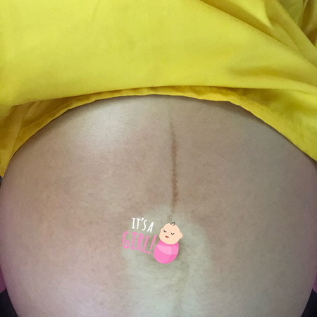 รอบสะดือ