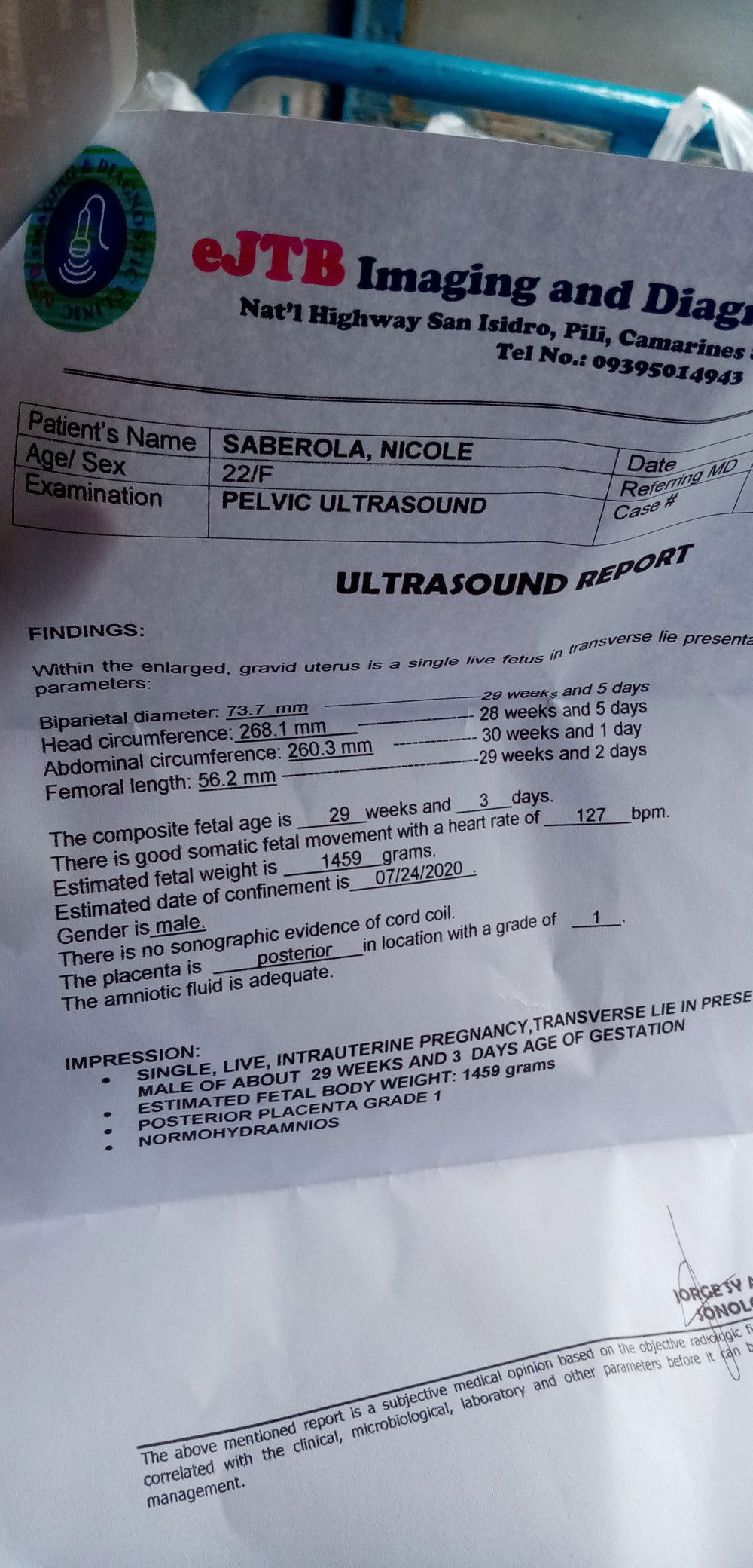Posterior Placenta Grade 1