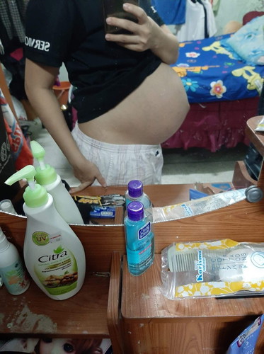 มาแชร์ประสบการณ์ค่ะ(รพ.รัฐ)