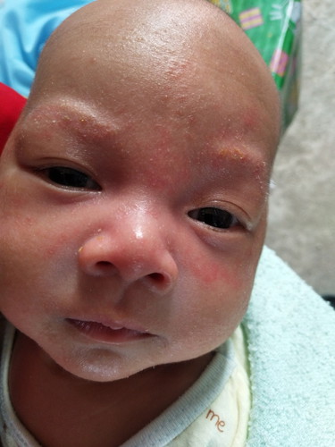 ทำไมคิ้วลูกเป็นแบบนี้