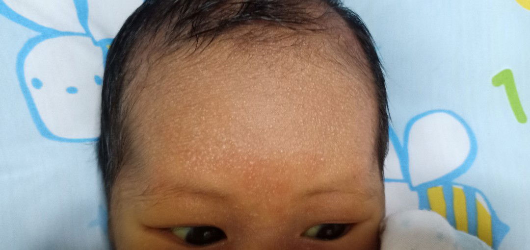 ลูกเป็นผื่นเเบบนี้ อันตรายไหมค่ะ