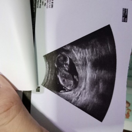ลูก