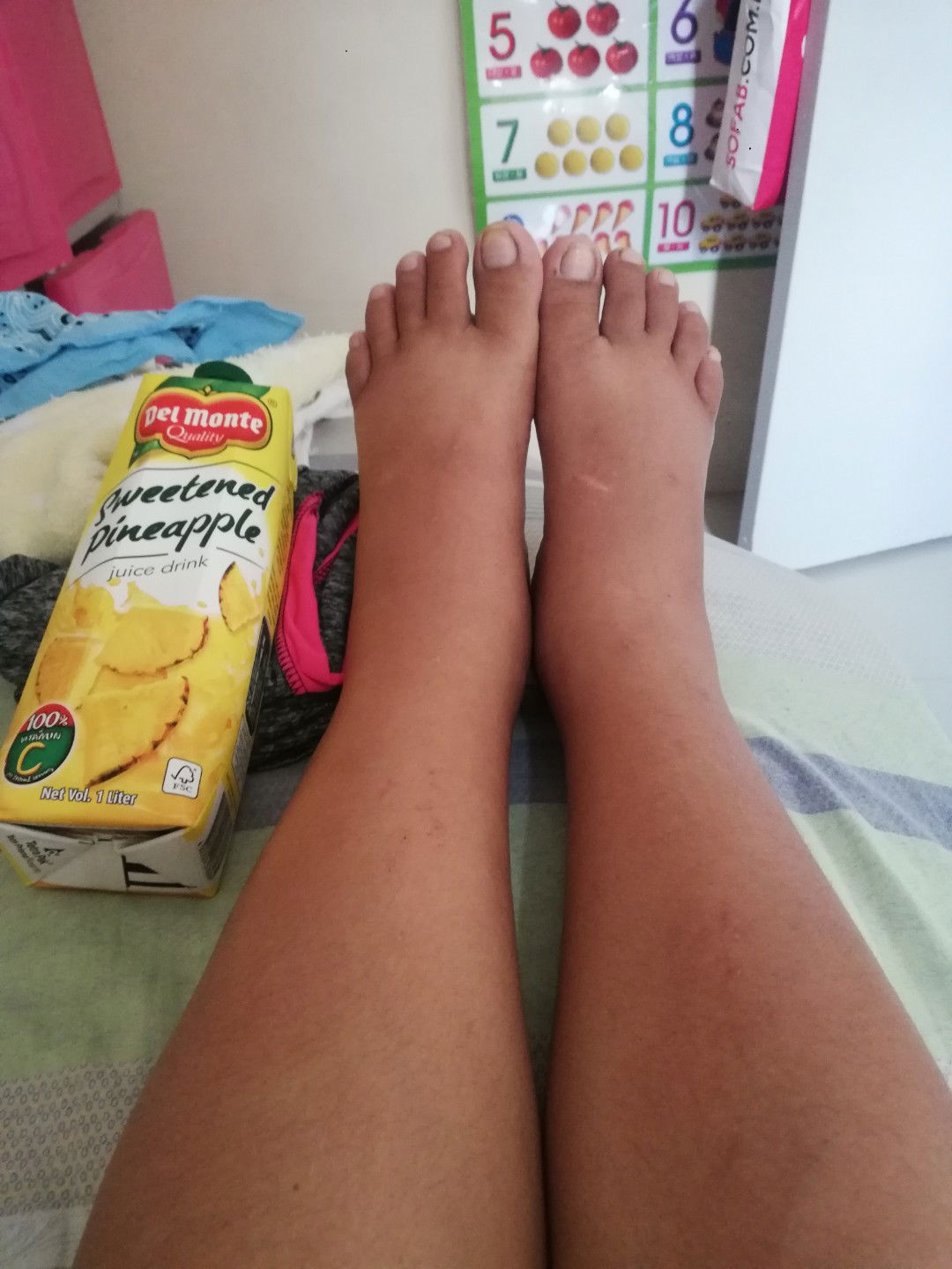 Pineapple And Pamamanas