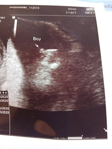 เดือนที่แล้วหมอบอกผุ้ชายค่ะเดือนนี้หมอบอกผุ้หญิงค่ะเพื่อนๆๆคิดว่ายังไงค่ะ