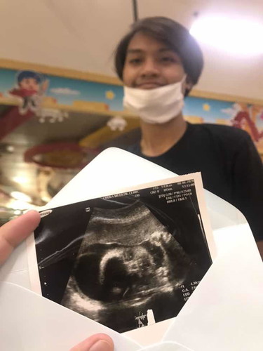 ไปซาวดูเพศน้องมาแล้ว